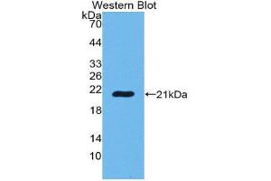 Western Blotting (WB) image for anti-POTE Ankyrin Domain Family, Member G (POTEG) (AA 177-330) antibody (ABIN1980492) (POTEG antibody  (AA 177-330))