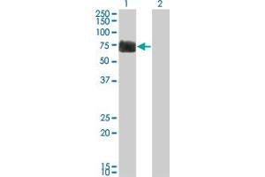 Western Blot analysis of RTN2 expression in transfected 293T cell line by RTN2 monoclonal antibody (M05), clone 6A11. (Reticulon 2 antibody  (AA 1-100))