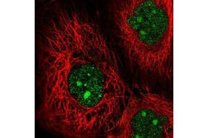 Immunofluorescent staining of A-431 cells with MAP3K9 polyclonal antibody  (Green) shows positivity in nucleus and nucleoli.