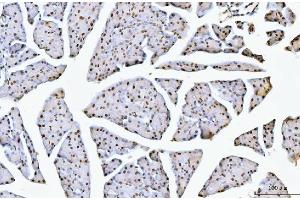 IHC analysis of NCL using anti-NCL antibody (ABIN7600662). (Nucleolin antibody  (AA 219-629))