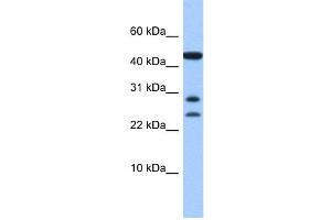 WB Suggested Anti-C20orf141 Antibody Titration: 0. (C20orf141 antibody  (Middle Region))