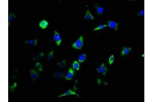 Immunofluorescence staining of SH-SY5Y cells with ABIN7147780 at 1:133, counter-stained with DAPI. (CNTF Receptor alpha antibody  (AA 106-342))