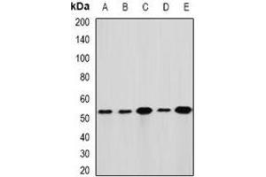 Western blot analysis of GLUD1 expression in Hela (A), HepG2 (B), mouse liver (C), mouse brain (D), rat kidney (E) whole cell lysates. (GLUD1 antibody)