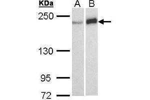 WB Image Sample (30 ug of whole cell lysate) A: A431 , B: Molt-4 , 5% SDS PAGE antibody diluted at 1:1000 (Werner Syndrome Protein (C-Term) antibody)