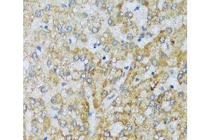 Immunohistochemistry of paraffin-embedded Human liver using C1QC Polyclonal Antibody at dilution of 1:100 (40x lens). (C1QC antibody)