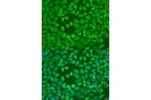 Immunofluorescence analysis of U2OS cells using EIF3A antibody (ABIN1679692, ABIN3015224, ABIN3015226 and ABIN6213890) at dilution of 1:100. (EIF3A antibody  (AA 1-250))