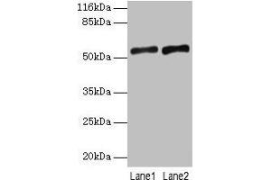 Western blot All lanes: SLC2A4 antibody at 2 μg/mL Lane 1: Mouse heart tissue Lane 2: Hela whole cell lysate Secondary Goat polyclonal to rabbit IgG at 1/10000 dilution Predicted band size: 55, 44 kDa Observed band size: 55 kDa (GLUT4 antibody  (AA 223-287))