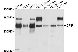 Western blot analysis of extracts of various cell lines, using BRIP1 antibody (ABIN5995423) at 1/1000 dilution. (BACH1 antibody)