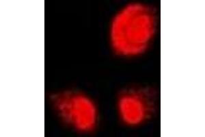 Immunofluorescent analysis of PSMB1 staining in U2OS cells. (PSMB1 antibody)