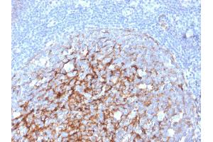 Immunohistochemistry (IHC) image for anti-Complement Component (3d/Epstein Barr Virus) Receptor 2 (CR2) (AA 142-240) antibody (ABIN6939185)