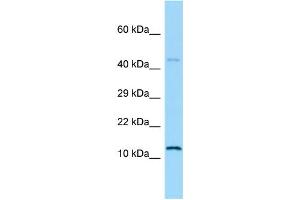 WB Suggested Anti-Hmga1 Antibody Titration: 2 ug/ml Positive Control: Rat Small Intestine (HMGA1 antibody  (N-Term))