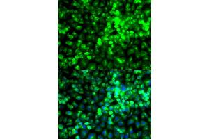 Immunofluorescence analysis of A549 cells using EIF2AK4 antibody. (GCN2 antibody)