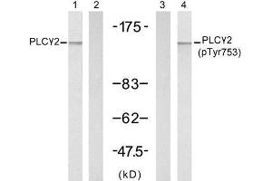 Western blot analysis of extracts from A431 cells, untreated or treated with EGF (200ng/ml, 5min), using PLCγ2 (Ab-753) antibody (E021186, Lane 1 and 2) and PLCγ2 (phospho-Tyr753) antibody (E011175, Lane 3 and 4). (Phospholipase C gamma 2 antibody)