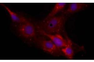 Image no. 1 for anti-Neurocan (NCAN) antibody (ABIN108596) (Neurocan antibody)