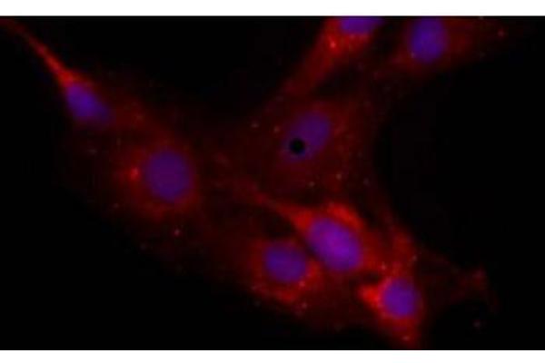 Neurocan antibody