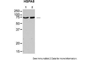 Sample type: rat brain lysatePrimary Dilution: 1:1000Image Submitted By: Jennifer Morgan, PhD &, David BuschUniversity of Texas in Austin (Hsc70 antibody  (N-Term))
