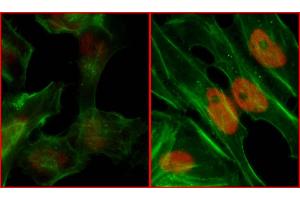 Immunofluorescence (IF) image for anti-Replication Protein A2, 32kDa (RPA2) (pSer4), (pSer8) antibody (ABIN7455212) (RPA2 antibody  (pSer4, pSer8))