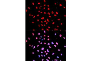 Immunofluorescence (IF) image for anti-Bruton Agammaglobulinemia tyrosine Kinase (BTK) (pTyr223) antibody (ABIN1876748) (BTK antibody  (pTyr223))
