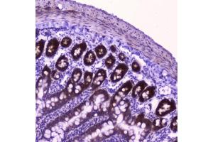 IHC testing of FFPE rat small intestine tissue with FLIP antibody at 2ug/ml. (FLIP antibody  (AA 1-376))