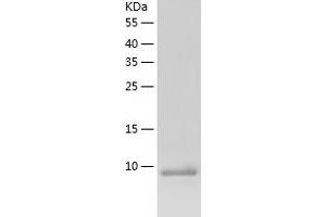 Western Blotting (WB) image for Acylphosphatase 1, Erythrocyte (Common) Type (Acyp1) (AA 1-99) protein (His tag) (ABIN7121689) (ACYP1 Protein (AA 1-99) (His tag))