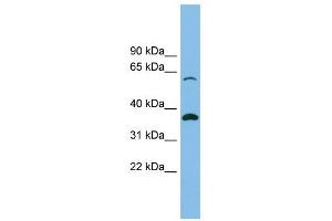 SLC25A4 antibody used at 1 ug/ml to detect target protein.