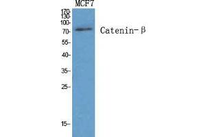 Western Blot (WB) analysis of specific cells using Catenin-beta Polyclonal Antibody. (beta Catenin antibody  (Ser290))