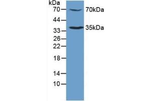 Figure. (MPL antibody  (AA 311-460))