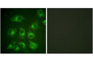 Immunofluorescence analysis of HuvEc cells, using CrkII (Ab-221) Antibody. (Crk antibody  (AA 187-236))