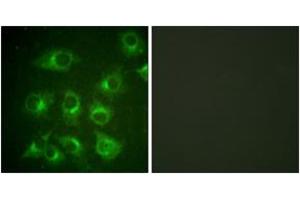 Immunofluorescence analysis of HuvEc cells, using CrkII (Ab-221) Antibody.