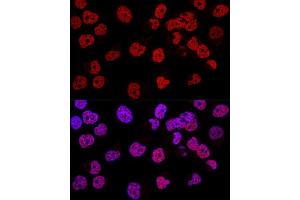 Confocal immunofluorescence analysis of Hela cells using WT1 Polyclonal Antibody (ABIN7271369) at dilution of 1:200. (WT1 antibody  (AA 1-302))