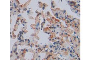 Used in DAB staining on fromalin fixed paraffin- embedded lung tissue (LARS antibody  (AA 260-509))