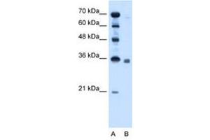 Image no. 1 for anti-Sphingosine-1-Phosphate Phosphatase 2 (SGPP2) (AA 301-350) antibody (ABIN205089) (SGPP2 antibody  (AA 301-350))