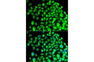 Immunofluorescence analysis of A549 cell using TBPL1 antibody.
