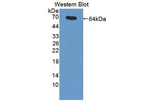 Western blot analysis of the recombinant protein. (MME antibody  (AA 455-750))