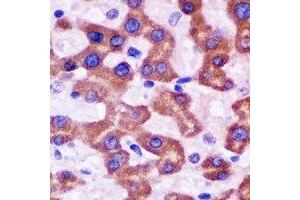 Immunohistochemical analysis of HAPLN1 staining in rat liver formalin fixed paraffin embedded tissue section. (HAPLN1 antibody)