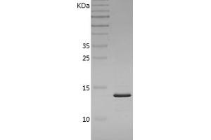 FABP4 Protein (AA 1-132) (His tag)