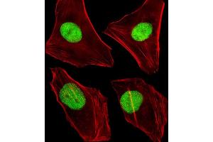 Immunofluorescent analysis of 4 % paraformaldehyde-fixed, 0. (DNMT1 antibody  (AA 881-914))