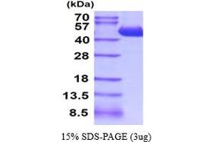 SDS-PAGE (SDS) image for Carboxypeptidase A4 (CPA4) (AA 17-421) protein (His tag) (ABIN5854528)