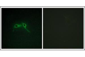 Immunofluorescence analysis of HepG2 cells, using NF1 Antibody. (Neurofibromin 1 antibody  (Internal Region))