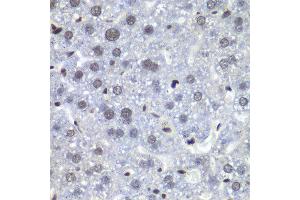 Immunohistochemistry of paraffin-embedded mouse liver using RBBP5 antibody at dilution of 1:100 (x40 lens). (RBBP5 antibody)