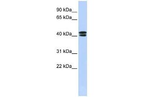 CACNB3 antibody used at 1 ug/ml to detect target protein. (CACNB3 antibody  (N-Term))
