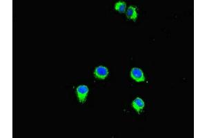 Immunofluorescent analysis of Hela cells using ABIN7160774 at dilution of 1:100 and Alexa Fluor 488-congugated AffiniPure Goat Anti-Rabbit IgG(H+L)