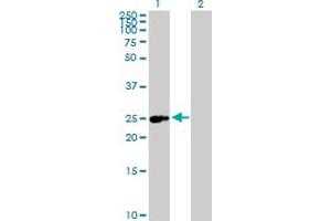 Western Blot analysis of ERAS expression in transfected 293T cell line by ERAS MaxPab polyclonal antibody. (ERAS antibody  (AA 1-233))