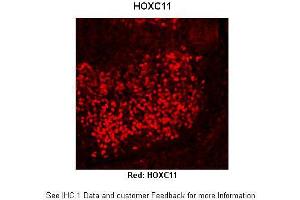 Immunohistochemistry (IHC) image for anti-Homeobox C11 (HOXC11) (Middle Region) antibody (ABIN2779771) (HOXC11 antibody  (Middle Region))