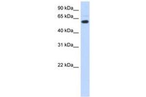 Image no. 1 for anti-Chromodomain Protein, Y-Like (CDYL) (AA 51-100) antibody (ABIN6743515) (CDYL antibody  (AA 51-100))