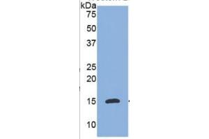 WB of Protein Standard: different control antibodies  against Highly purified E. (IL-8 ELISA Kit)