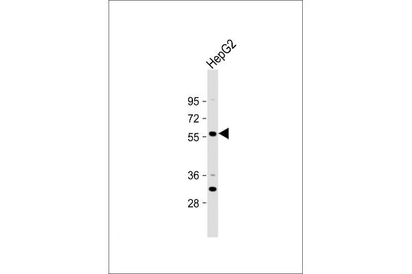 ST6GAL2 antibody  (C-Term)