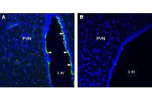 Expression CMKLR1 in rat paraventricular nucleus (PVN).
