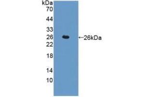 Detection of Recombinant CTSL, Human using Polyclonal Antibody to Cathepsin L (CTSL) (Cathepsin L antibody  (AA 114-288))