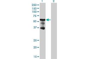 Western Blot analysis of PKNOX2 expression in transfected 293T cell line by PKNOX2 monoclonal antibody (M01), clone 4B6. (PKNOX2 antibody  (AA 116-215))